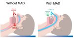 1745349625 how-mad-works thumb